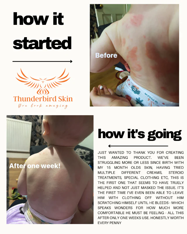Skin Calming Tonic - Image 8